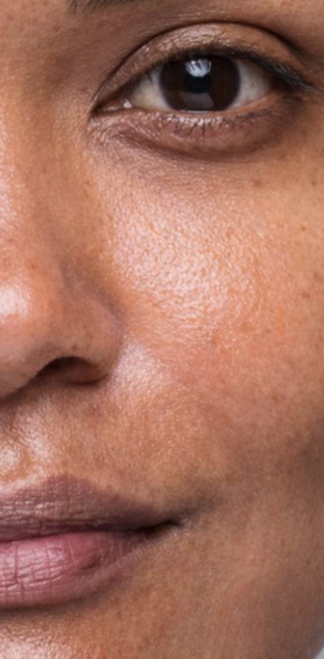 Antes do peeling de diamante