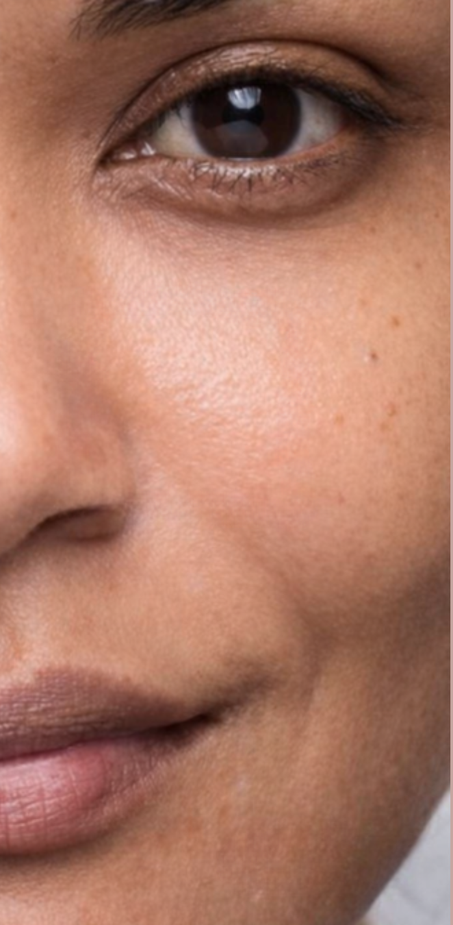 Depois do peeling de diamante